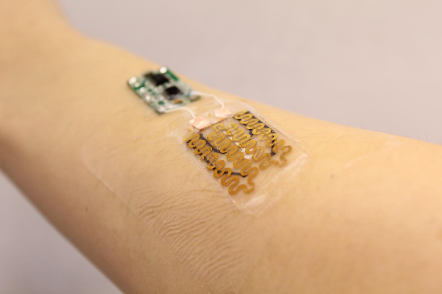 Smart Wound Dressings: The Future of Healing